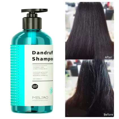 Nourishing Deep Cleansing Anti Dandruff Hair Shampoo