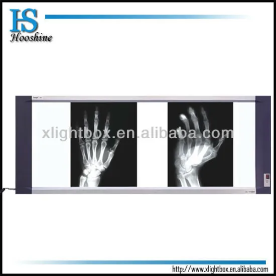 X-ray viewing box --popular and useful