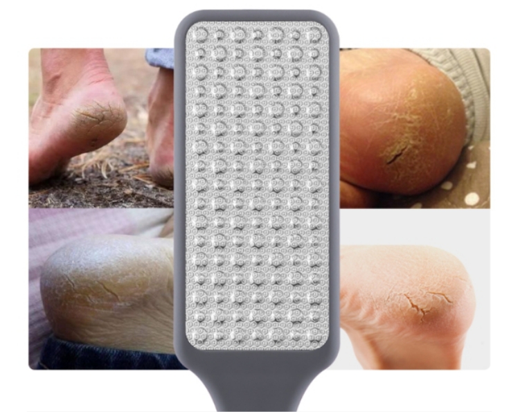 Dual Sided Callus Remover (5)