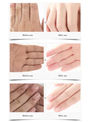 Omylady Skincare: Free Sample Electric Vibrating Massage Hand Cream and Hand Mask