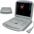 Full Digital Color Doppler Laptop Ultraschallmaschine