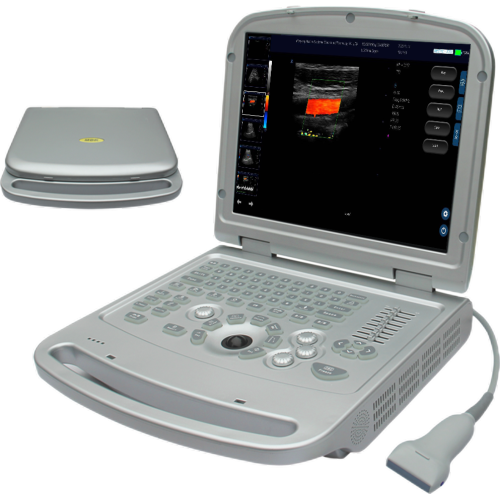 Full digital Color doppler laptop ultrasonic machine