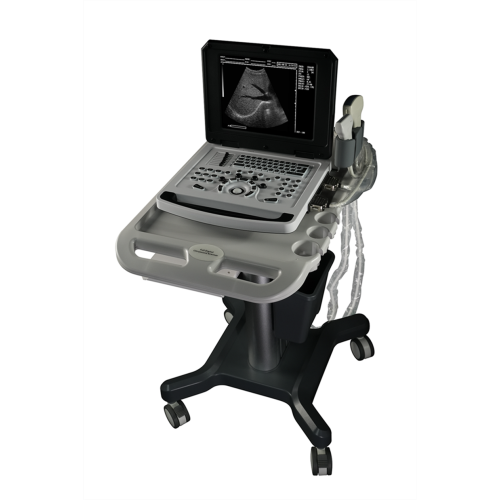 Cheap Notebook Black and White Ultrasound Scanner