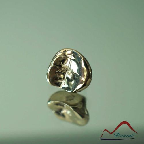 DENTAL Molar Gold Onlay