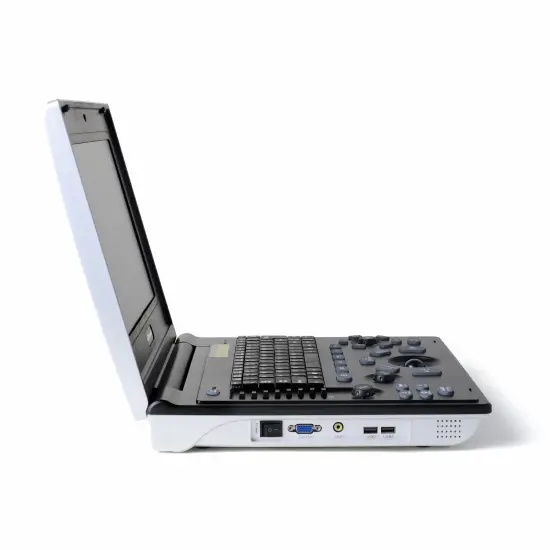 Children gallbladder polyps ultrasound diagnosis instrument