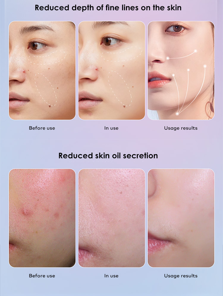 red light therapy for skin rejuvenation