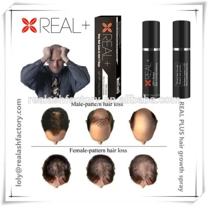 Best anti hair loss product REAL PLUS hair loss treatment/best hair loss product treatment/hair growth spray