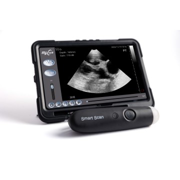 SmartScan B portable veterinary ultrasound machine price