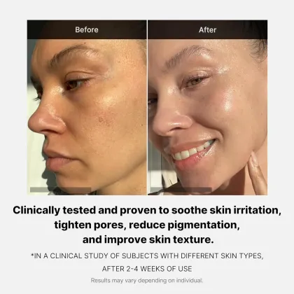 Korean Skincare: Whitening, Moisturizing Serum and Anti-Wrinkle Masks
