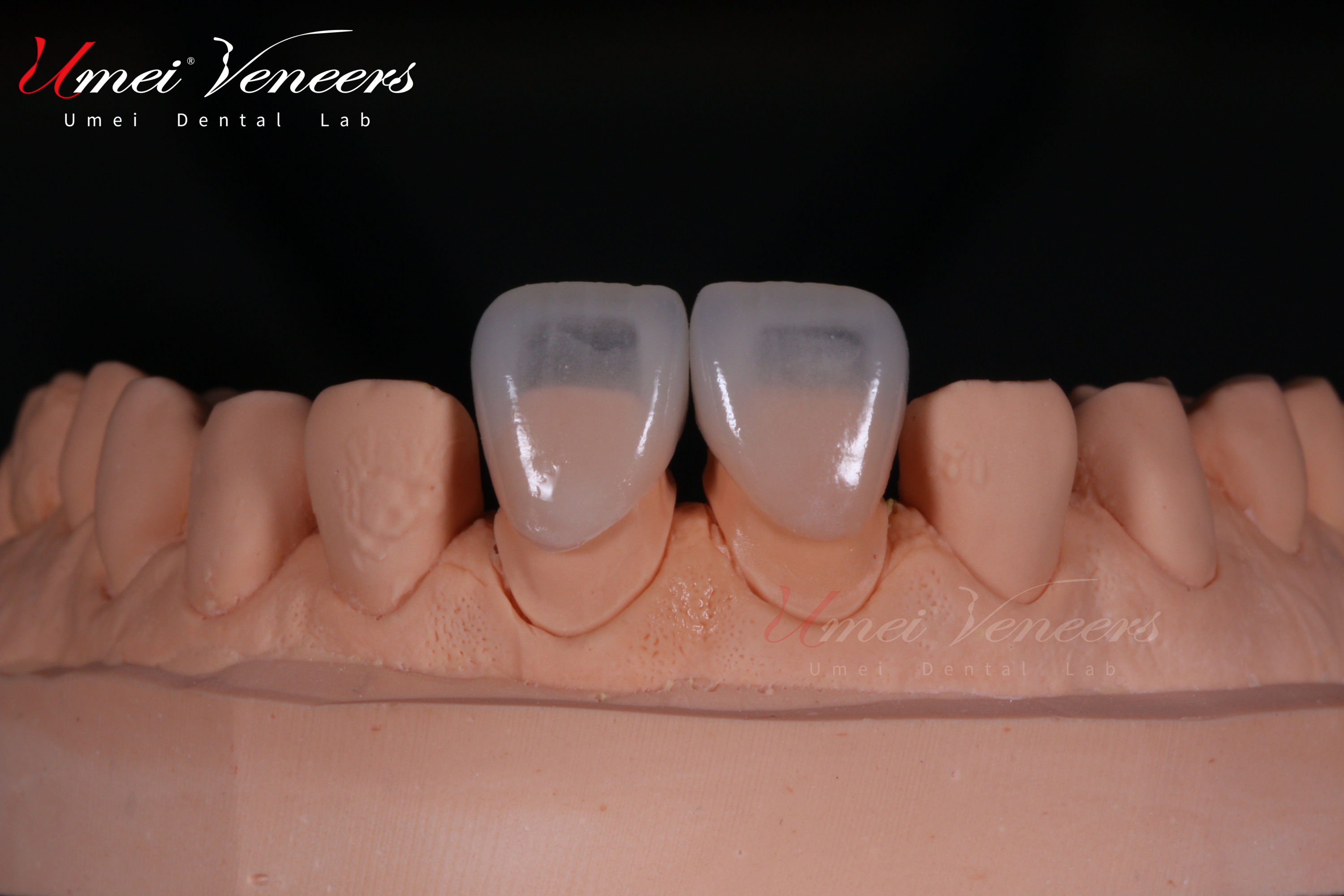 Refractory Veneers