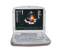 Machine à ultrasons portable Doppler couleur portable de haute qualité 4d