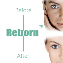 Снимите веснушку Reborn Liquid Dermal Filler