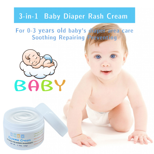 Mejor crema de alivio de tratamiento de eccema herbal bebé crema