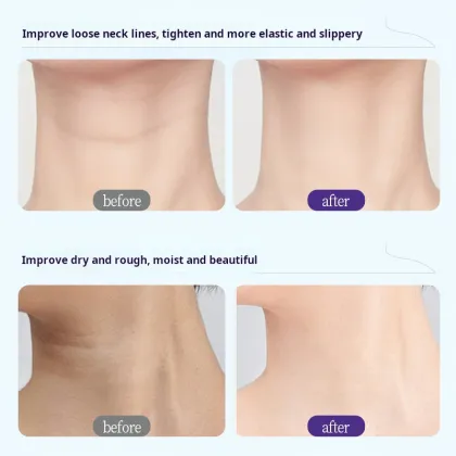 Ruofu Polypeptide Special Moisturizing Neck Cream