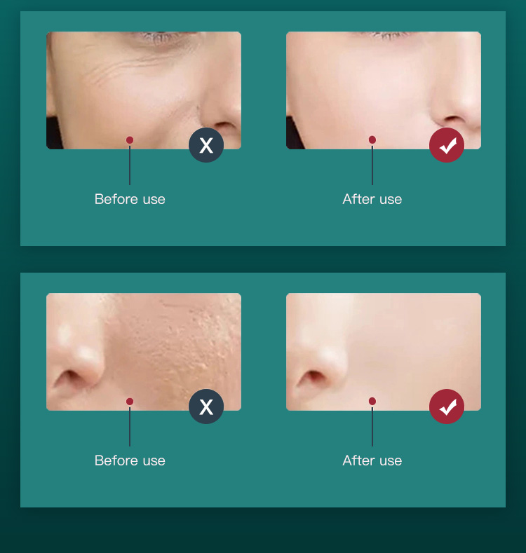 Red Light Therapy for Face LED Light Therapy2(15)