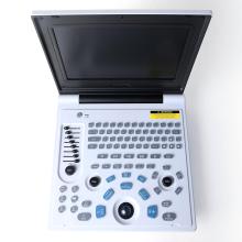 Дзеці поліцыстычная печань ультрагукавога дыягнастычнага інструмента