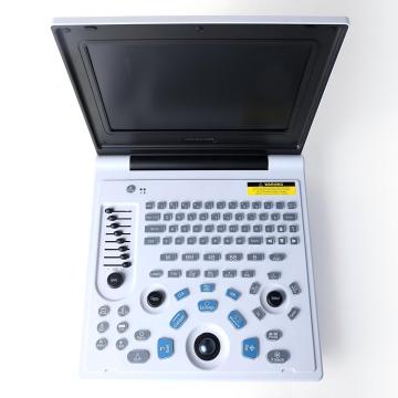 Дзеці поліцыстычная печань ультрагукавога дыягнастычнага інструмента