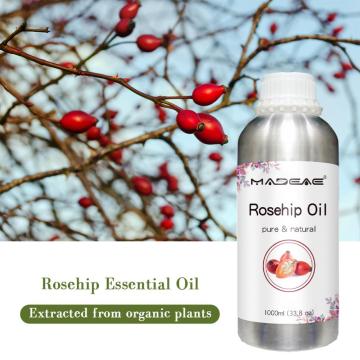 Extrato de planta pura Rosehip Óleo essencial para cuidados com a pele de grau cosmético Óleo de roseira orgânica natural