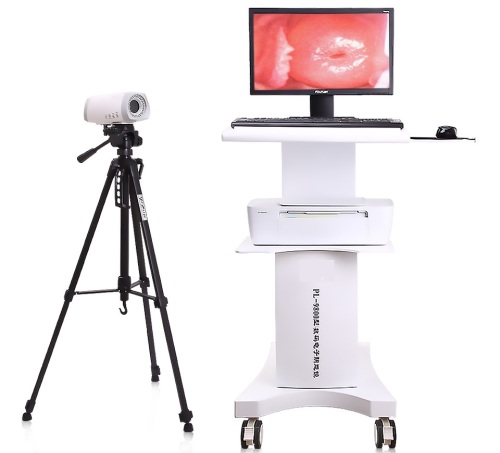 Colposcope vidéo portatif numérique médical pour la gynécologie