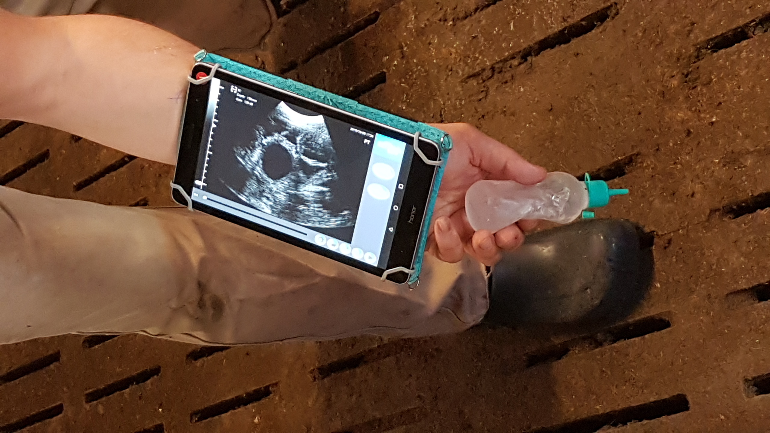 best wireless ultrasound probe