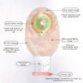 sacca per colostomia di colostomia medica uptodati di ostomia sacca colostomia da stoma borse