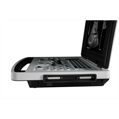 Li Battery Notebook B Ultrasound Scanner