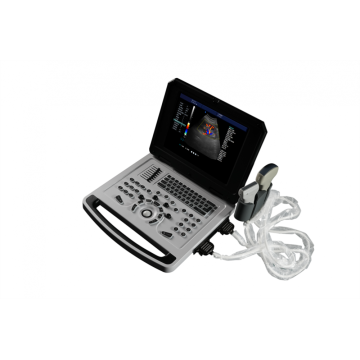 Scanner de ultrassom Doppler colorido para notebook para vascular