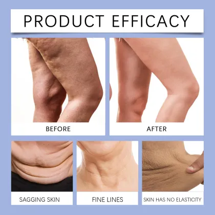 Hot Belly Firming Cream: 30ml Anti-Cellulite Body Shaping Slimming Cream to Effectively Burn Fat