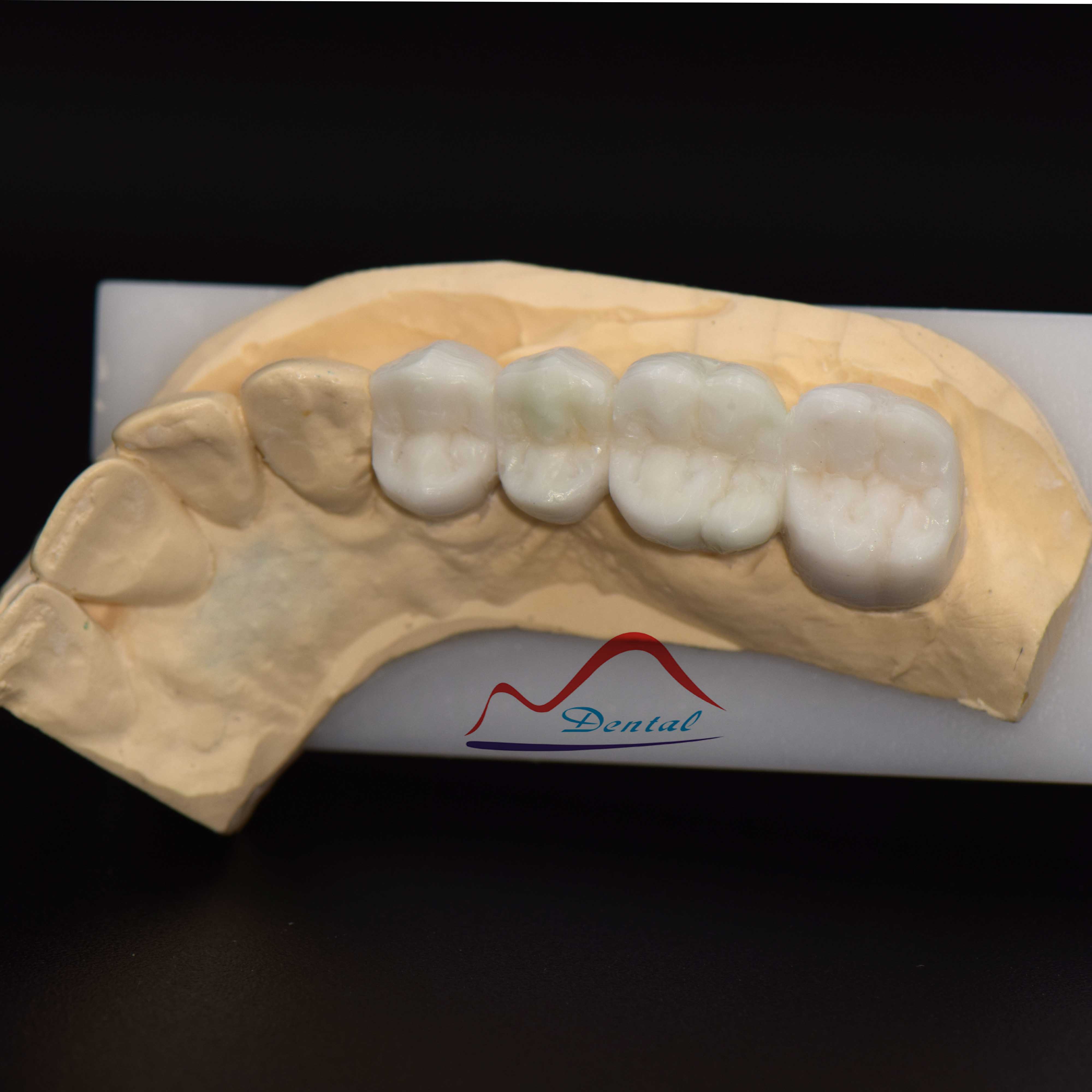Posterior Aestherics Diagnostic Wax c