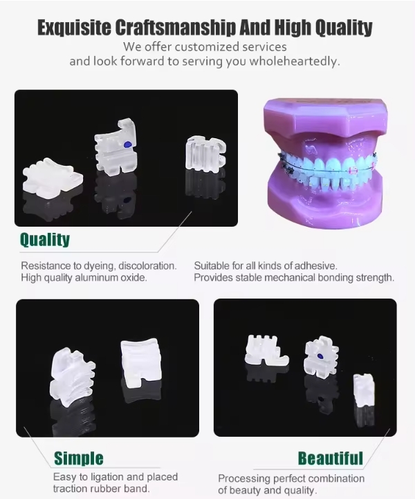 Orthodontic ceramic bracket 1