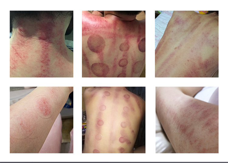 cavitation machine cellulite remover for legs face sculpting skin tightening device07