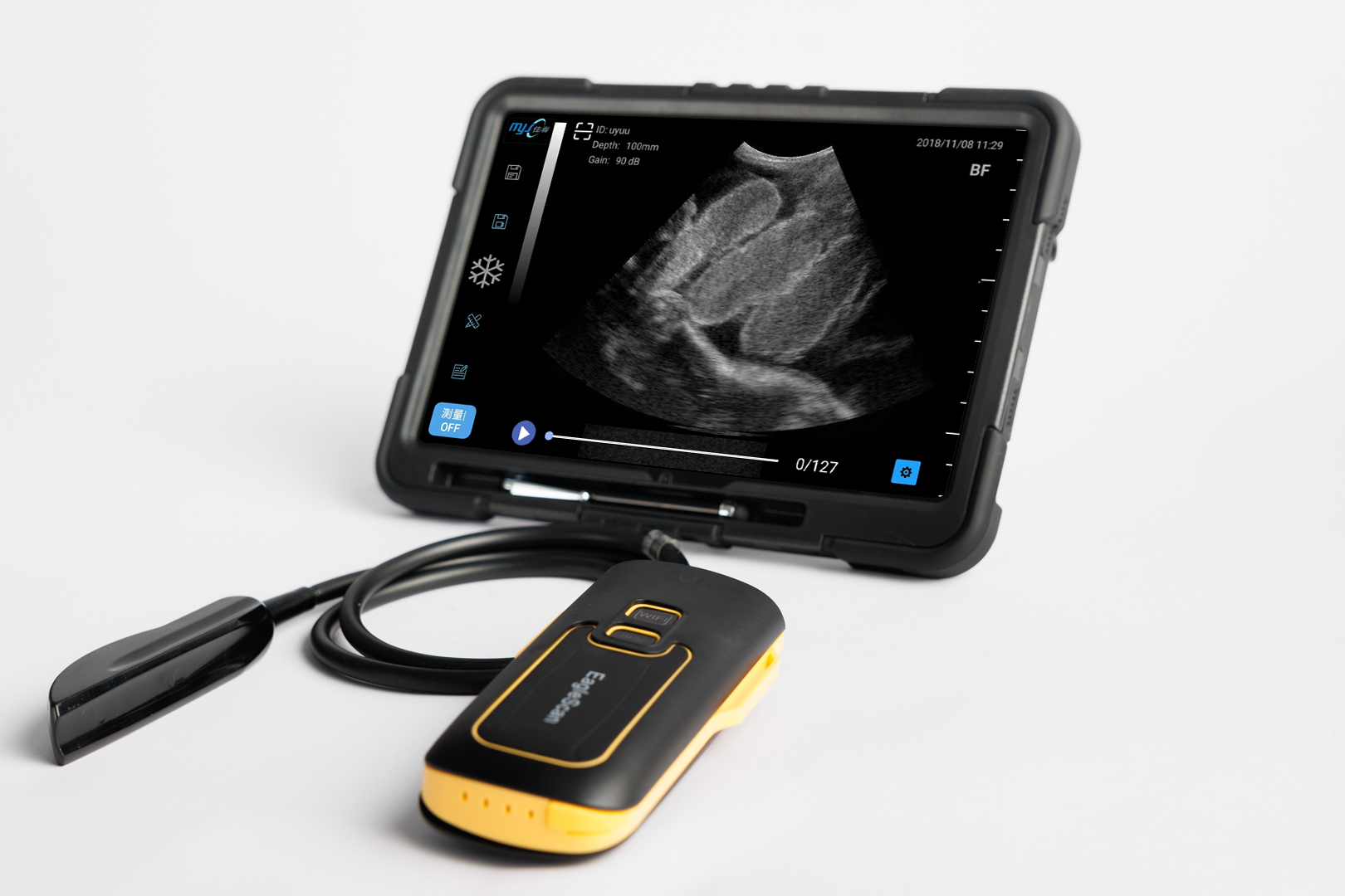 ultrasound machine price