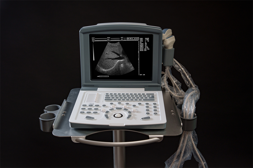 white and black full digital laptop ultrasound scanner