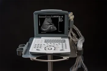 white and black full digital laptop ultrasound scanner
