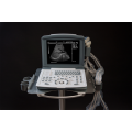 Escáner de ultrasonido de laptop digital blanco y negro completo