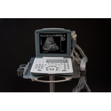 white and black full digital laptop ultrasound scanner