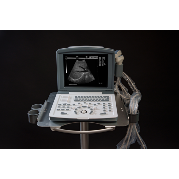 white and black full digital laptop ultrasound scanner