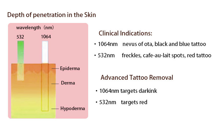 Pico Laser For Tattoo Removal