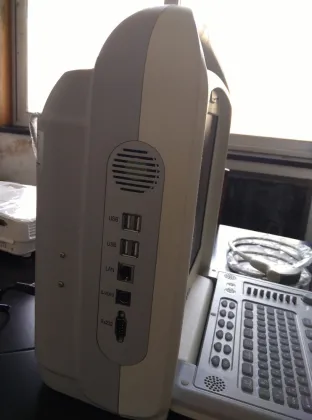 Portable sonoscape ultrasound echocardiography echo machine