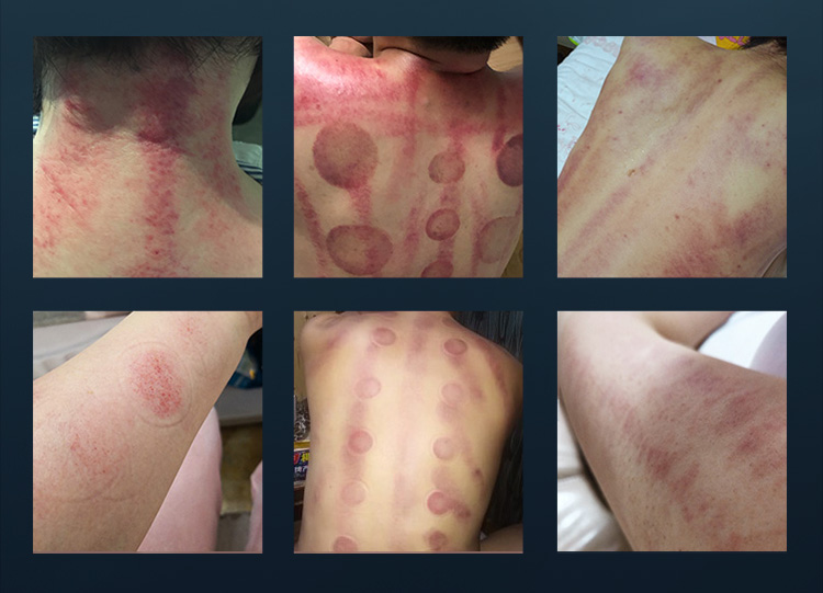 6 in 1 cavitation machine