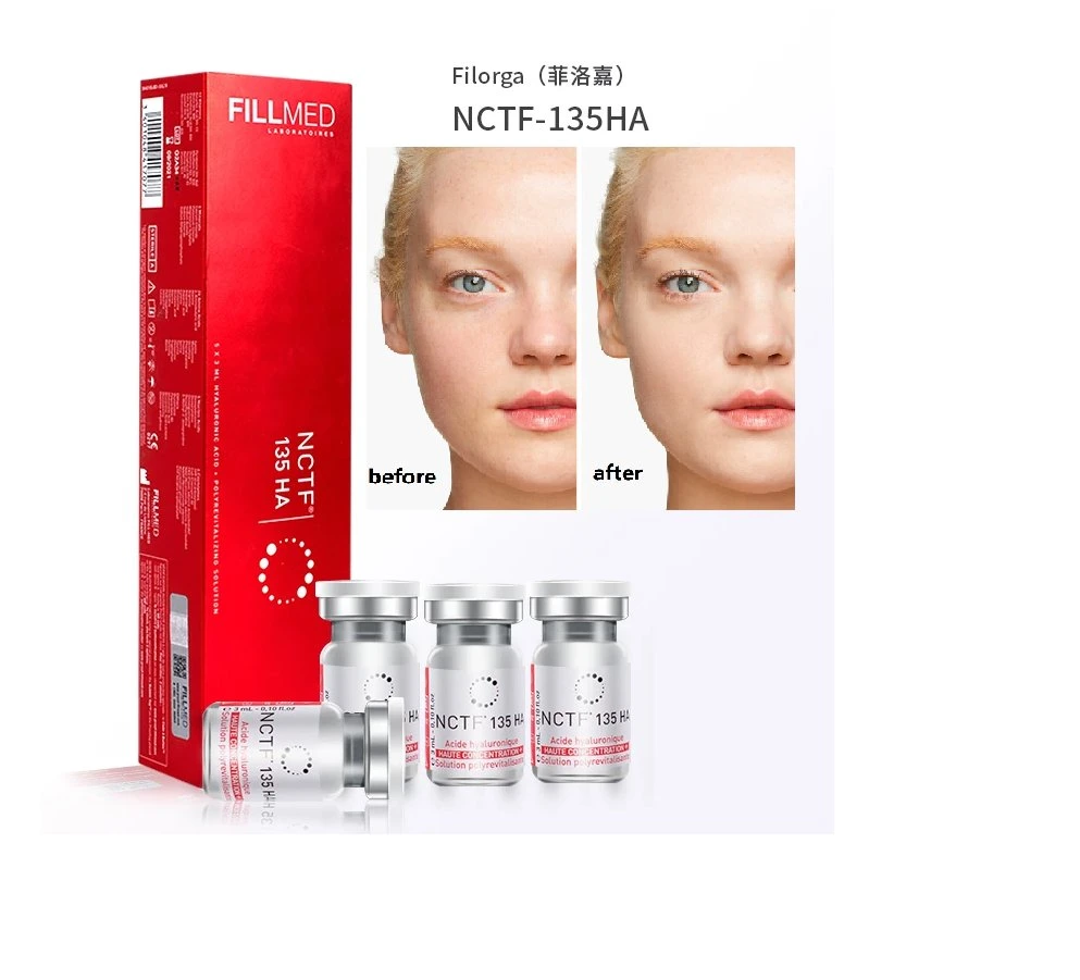 NCTF 135HA Dermal Filler Fillmed