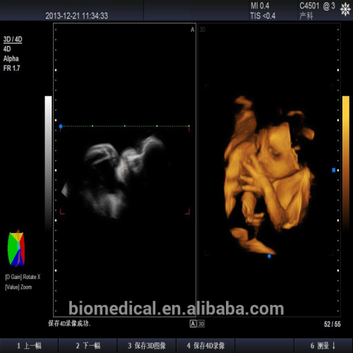 New Arrival Professional Diagnostic System 3d Color Doppler Ultrasound ...