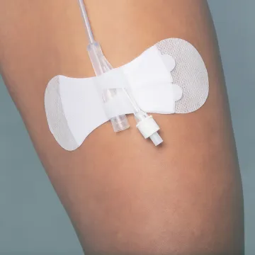 Sample Available IV Catheter Fixation Dressing and Securement Device
