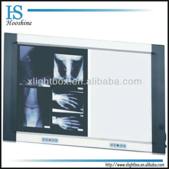 3 banks X-ray film viewer