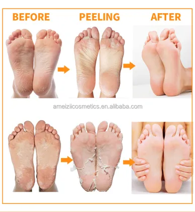Pure nourishing foot peel mask gel foot skin