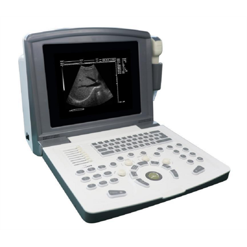 Portable Black and White Ultrasound Scanner for Gynecology