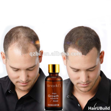 High-Effective Hair Serum for Men and Women - Nourish and Promote Hair Growth (Private Label)