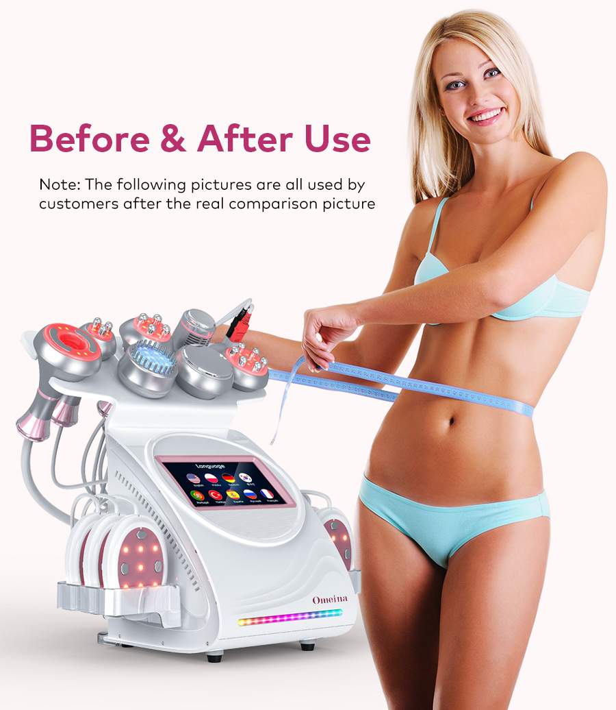 Omeina best cavitation machine for home use