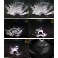 Sonda sem fio Doppler cor de intracavidade