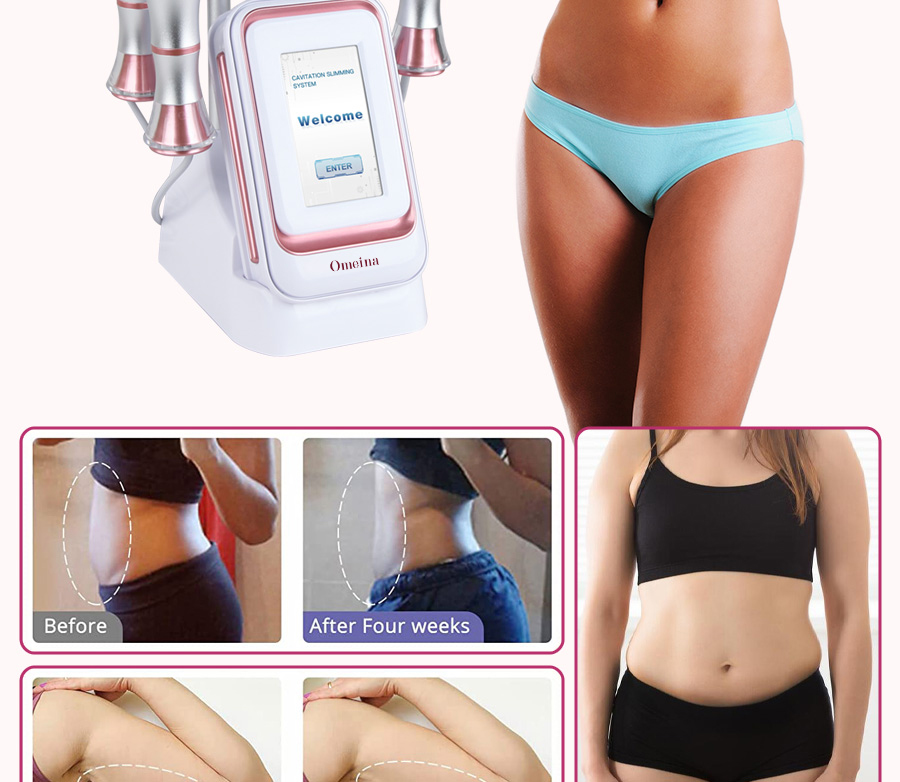 body cavitation before and after